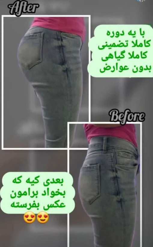 دوره افزایش حجم باسن /دوره ۴۰ روزه ـ۴تا ۶ سایز