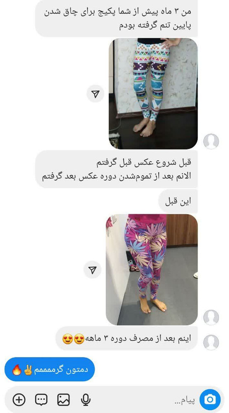افزایش حجم باسن/۱۲۰ روزه ـ ۱۶ سایز ...دوره Vip